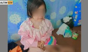 Foto : Seorang Bocah 10 Tahun Disiksa Oleh Keluarganya, Hingga Kedua Kaki Patah. Sumber : Istimewa.