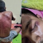 Foto: Seorang pengepul pisang bernama Puji Friayadi menjadi korban dugaan kekerasan yang dilakukan aparat Brimob Kukar. Sumber: Istimewa.