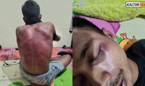 Foto: Seorang pengepul pisang bernama Puji Friayadi menjadi korban dugaan kekerasan yang dilakukan aparat Brimob Kukar. Sumber: Istimewa.