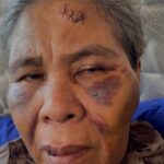 Foto: Suadah korban kekerasan. Sumber: Istimewa.